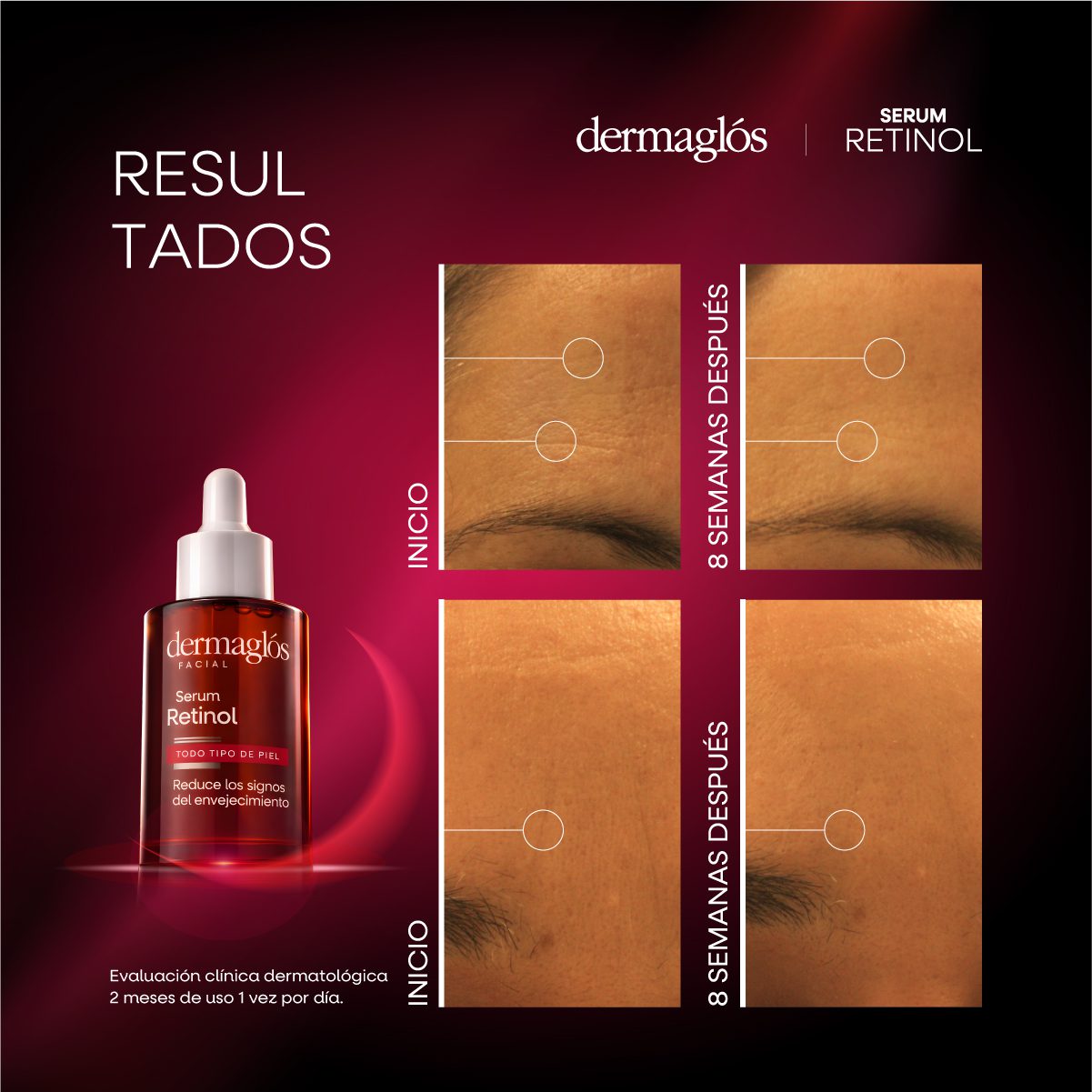 DERMAGLOS SERUM RETINOL 25 ML - Imagen 6
